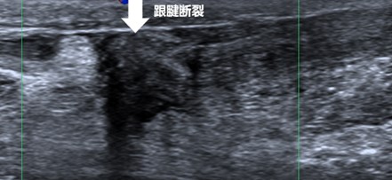16971031532386.jpg