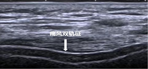 16971034652153.jpg