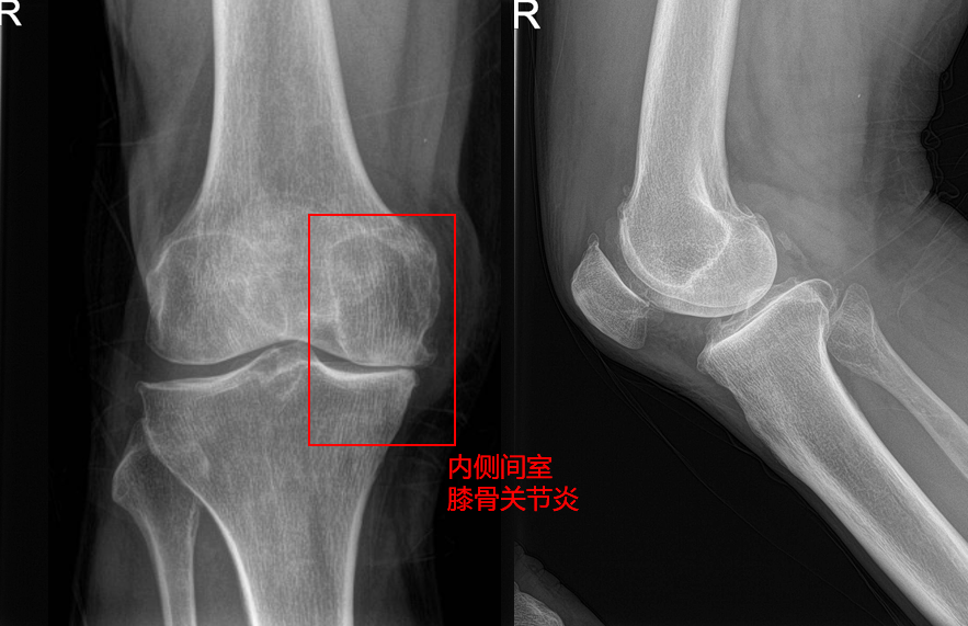 图片 3.png