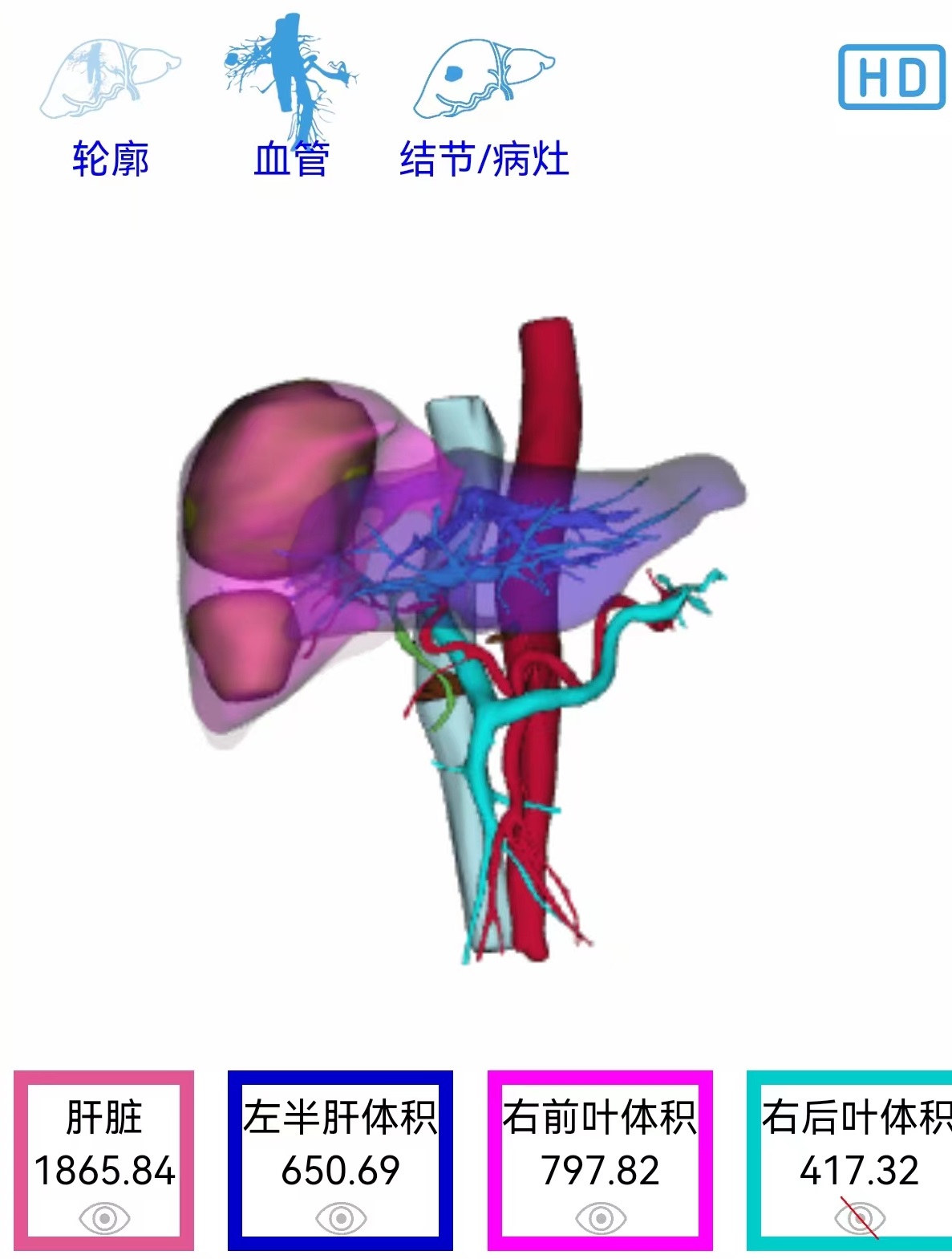 术后30天.jpg
